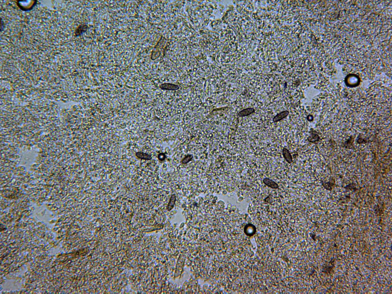 Microscopía de Tilachlidium brachiatum - 14 - Base sustrato amarillo x 400